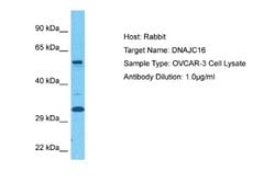 DNAJC16 Rabbit anti-Human, Polyclonal, Novus Biologicals 0.1 mL | Buy Online | Novus Biologicals | Fisher Scientific